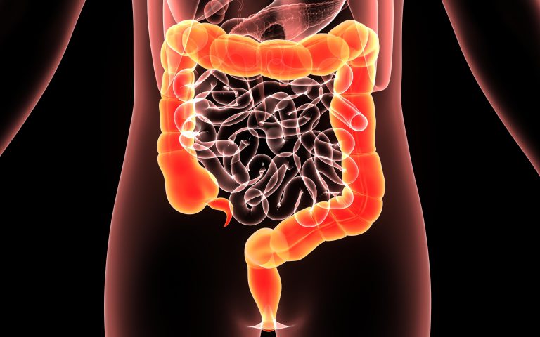 Colorectal Surgery